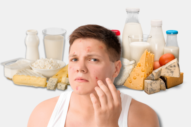 Young man touching his acne with sugary and dairy products in the background