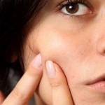 Permalink to: Is Acne due to Sugar, Dairy Products, and Bad Fats?