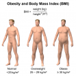 Permalink to: Unraveling Obesity? All Roads Lead to the Brain!